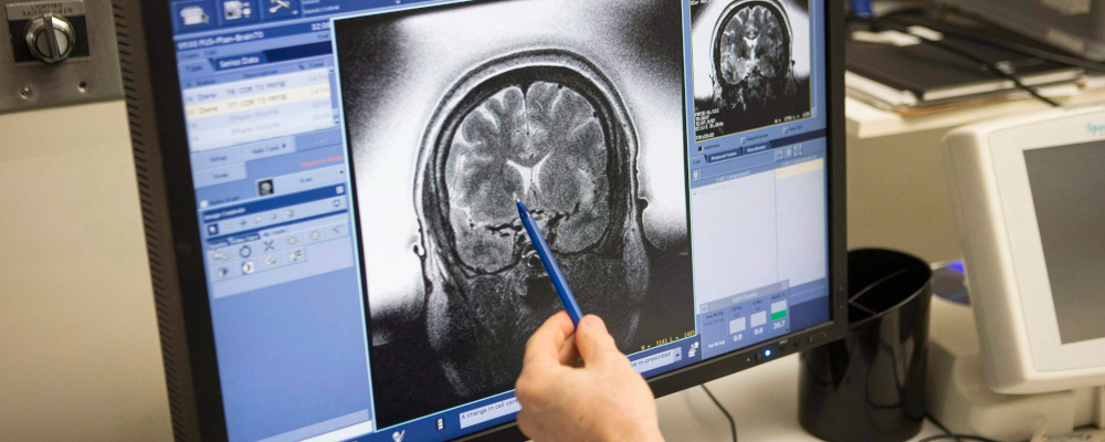 Psychiatrist Dr. Anthony Levitt points to lesions on an image of Sky Zazlov brain after she is placed in a MRI machine for a focused ultrasound procedure, at Toronto's Sunnybrook Hospital Tuesday, May 1, 2018. Chris Young/The Canadian Press. 